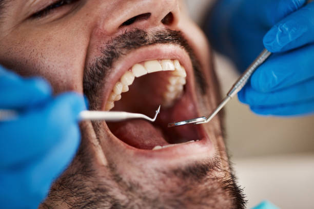 Best Walk-In Emergency Dentist in Oldsmar, FL